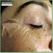 Danne skin therapy beauty acne anti aging Environ