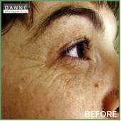 Danne skin therapy beauty acne anti aging Environ